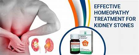 kidney stones